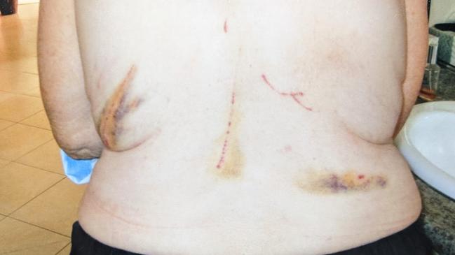 Suzanne Gransden was left bruised and scratched after being pounced on and knocked over by a wallaby in September.