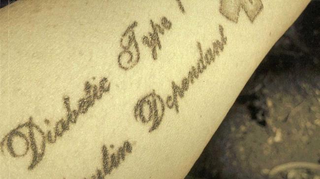 Celeste Barnard's My Life as a Diabetic's front cover shows her medical alert tattoo. Picture: Contributed