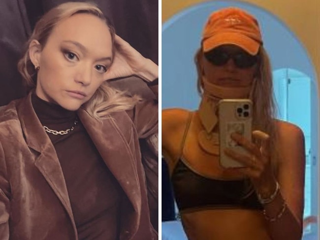37yo supermodel’s shock injury reveal