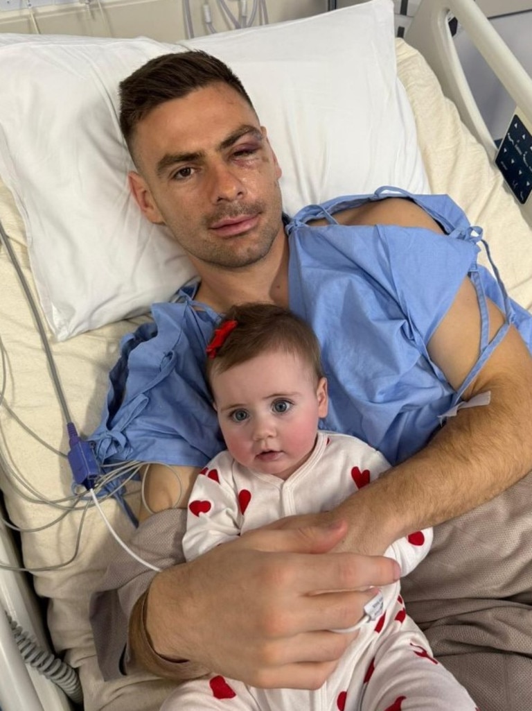 Stephen Coniglio had post season surgery. Photo: Instagram.