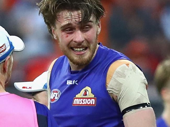 SYDNEY, AUSTRALIA - SEPTEMBER 24: Jordan Roughead of the Bulldogs reacts after being hit by ball the during the AFL First Preliminary Final match between the Greater Western Sydney Giants and the Western Bulldogs at Spotless Stadium on September 24, 2016 in Sydney, Australia. (Photo by Ryan Pierse/Getty Images)
