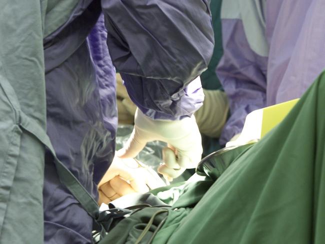 Surgeons perform an operation in the surgical room at Nambour Selangor hospital.Photo: Nicholas Falconer / Sunshine Coast Daily