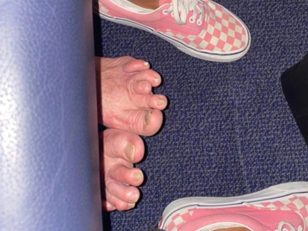 Passengers with bare feet are not a rare occurrence on planes. One person took a snap of this passenger’s ‘gross’ feet, with the photo also going viral on social media. Picture: Reddit