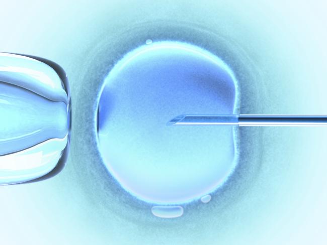 Leave to attend IVF appoints is included in the agreement.