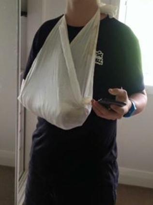 This kid says he broke his arm on purpose. Picture: Facebook