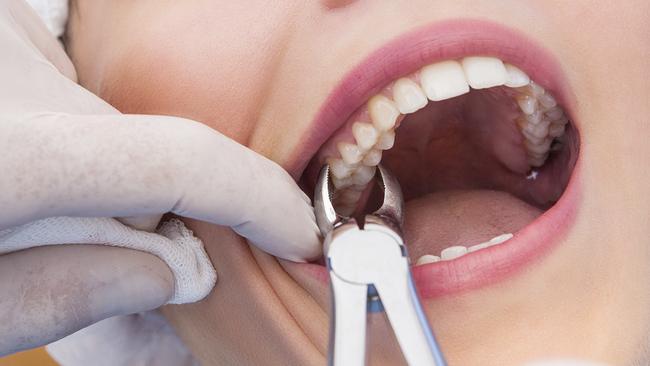 A Far North dentist is calling for fluoride to be reintroduced into water supplies across regional Queensland.