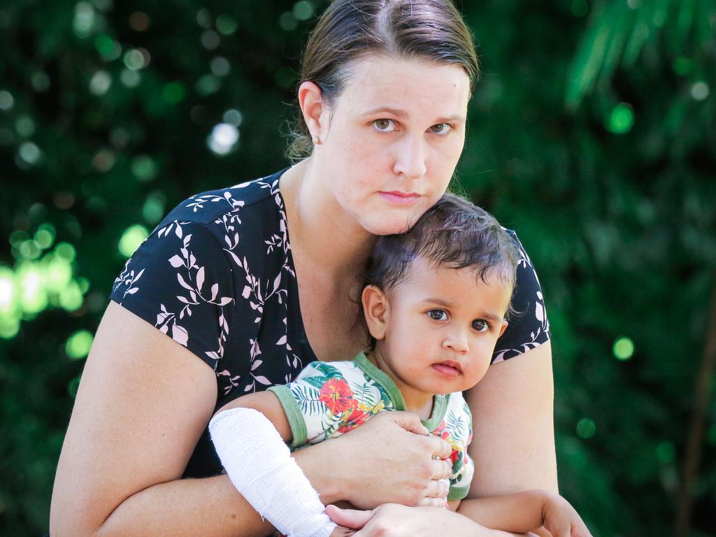 Shauna Mounsey with her son Lloyd Jayathilaka who was attacked by an unrestrained dog in the Botanical Gardens. Picture: Glenn Campbell