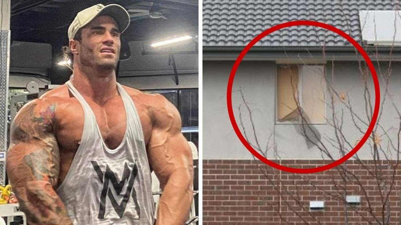 Calum von Moger's friends share major update after injury