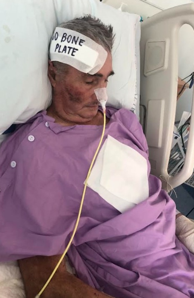 Rockhampton horse trainer John Poots underwent multiple brain surgeries.