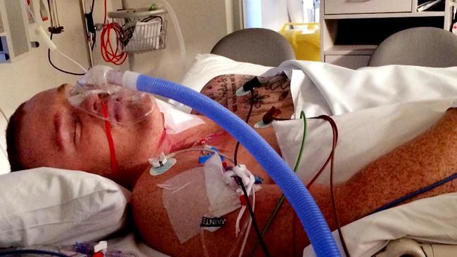 Alex McKinnon while in ICU at the Royal Alfred Hospital.