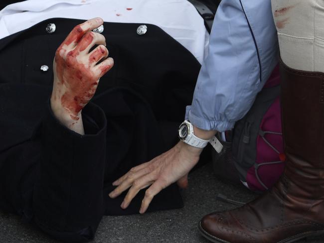 An injured man is assisted after an attack on Westminster Bridge in London, Britain March 22, 2017. REUTERS/Toby Melville