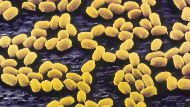 Weaponised anthrax bacteria spores were released over a Russian city in 1979.