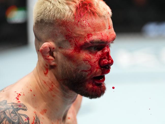 Serhiy Sidey’s nose looked broken early on. Picture: Jeff Bottari/Zuffa LLC via Getty Images