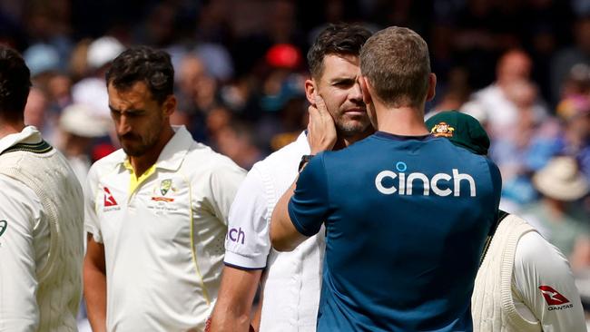 England's James Anderson (C) is looked over after taking a short ball from Mitchell Starc. Picture: AFP