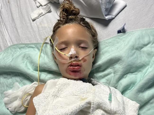 TikTok challenge leaves girl, 7, in a coma