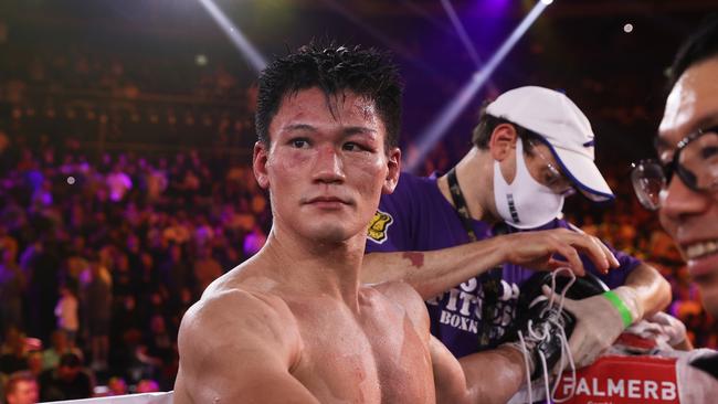 That face copped plenty of punishment. Photo by Mark Kolbe/Getty Images