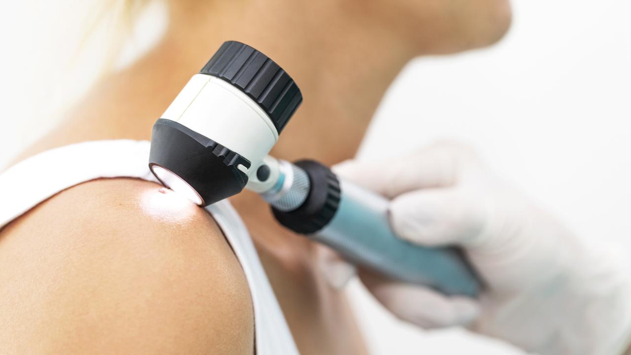 Skin cancer checks require expertise and equipment. Picture: iStock