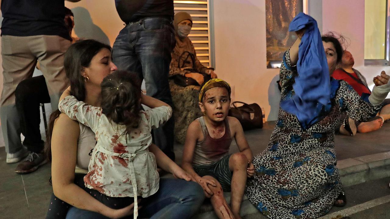 Wounded people wait to received help outside a hospital. Picture: AFP