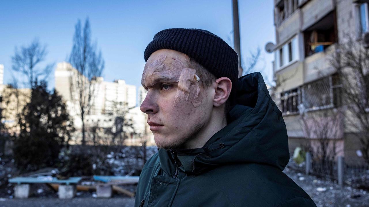 An injured resident stands by a residential building which was hit by the debris from a downed rocket in Kyiv. Picture: Fadel Senna