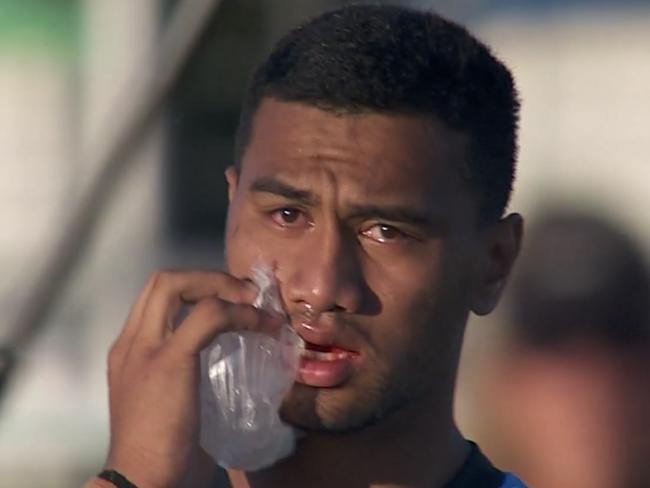 Cronulla winger Ronaldo Mulitalo breaks down after suspected season-ending injury.