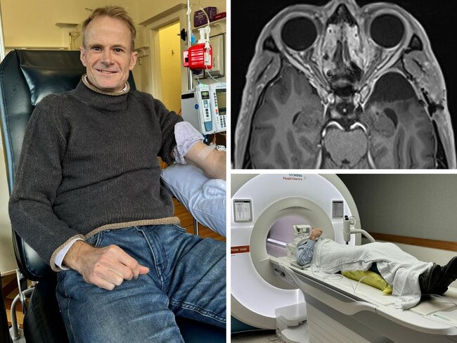 Dr Richard Scolyer faced ‘certain death’ - now he’s cancer-free. Picture: Instagram/RichardScolyer