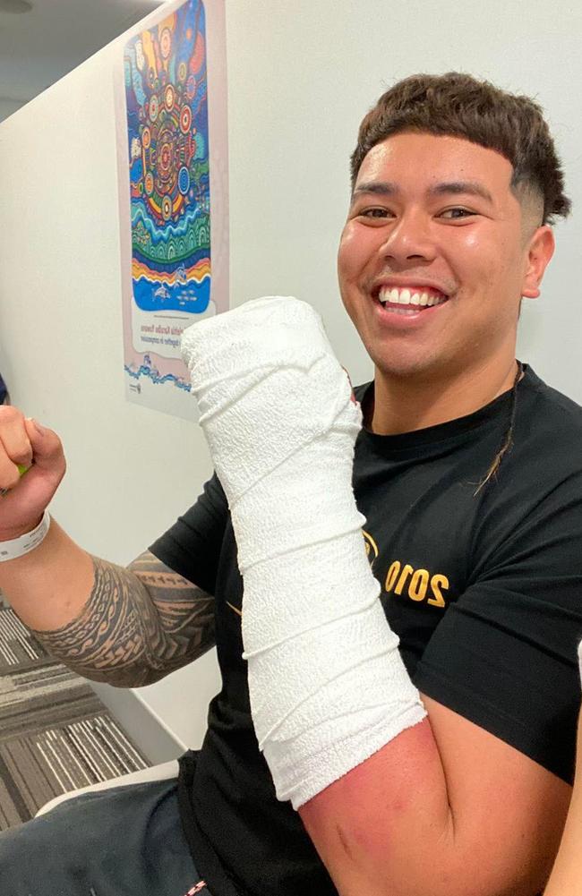 Josh Hippolite with arm injuries.