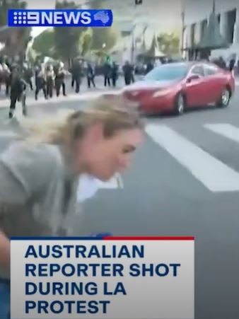 The shocking moment Lauren Tomasi was hit with a rubber bullet..
