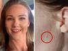 ‘Pimple’ leads to mum’s scary diagnosis