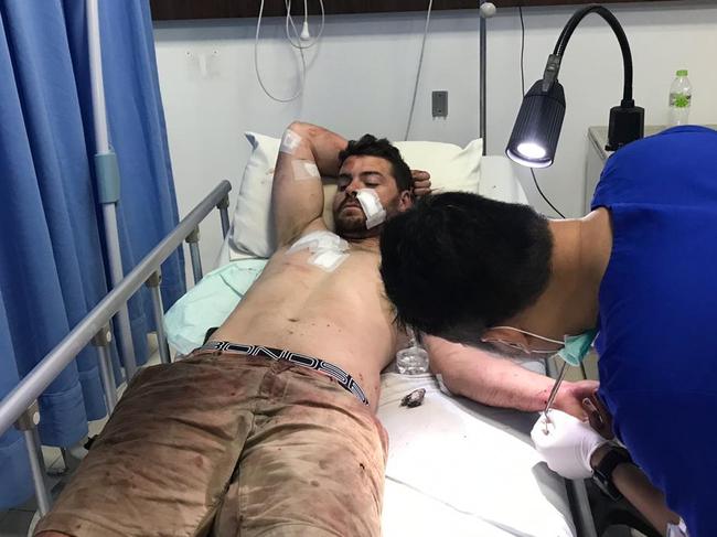 Australian Nicholas Carr is treated after his booze-fuelled Bali rampage came to an end. Picture: Lukman S. Bintoro