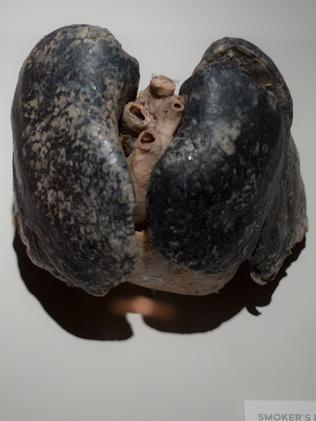 Real human organs will be on display at the exhibition.