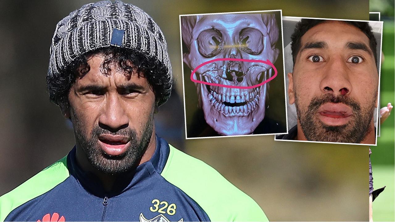 Canberra Raiders veteran Sia Soliola aids Corey Horsburgh's fiery