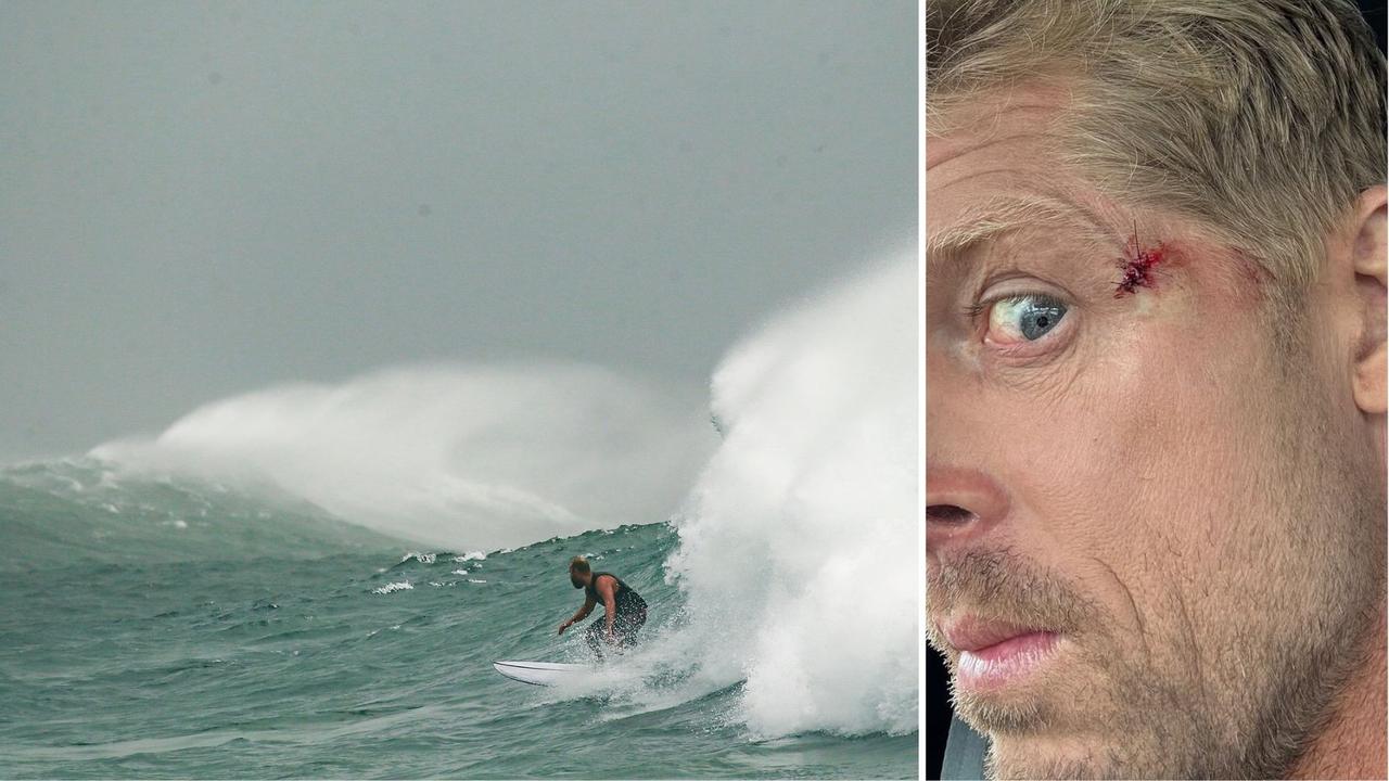 World champion surfer injured in cyclonic swell