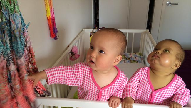 Sunny, right, was diagnosed with biliary atresia as a baby and had two liver transplants.