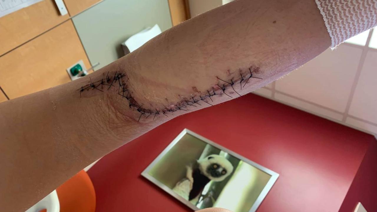 Michelle now wants to warn others about the risks. Picture: Michelle Hill