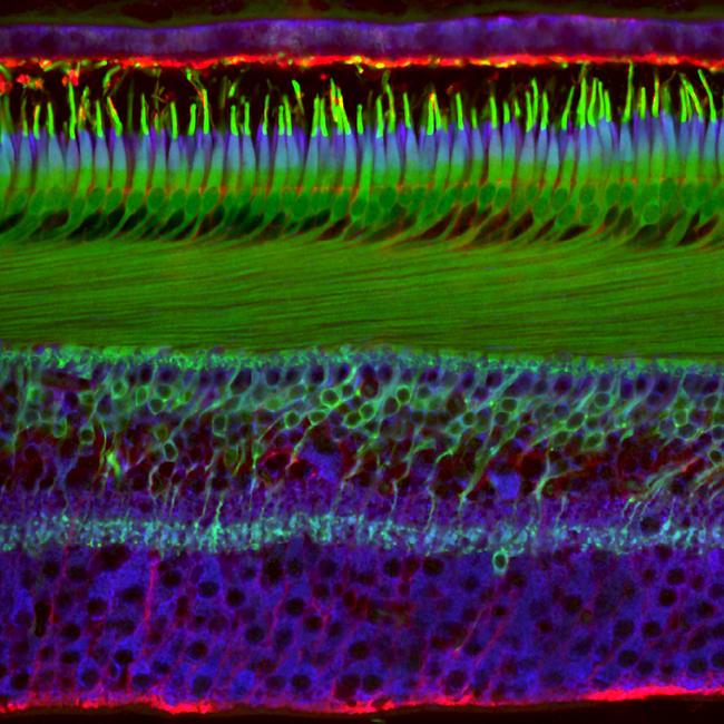 20th Place Human retina Picture: Dr. NicolÃ¡s Cuenca & Isabel OrtuÃ±o-LizarÃ¡n