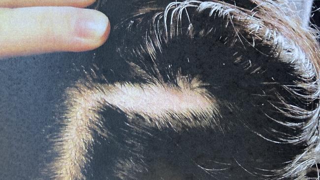 Jessica Camilleri has pleaded guilty to violently attacking two prison guards at Silverwater Jail in 2021.