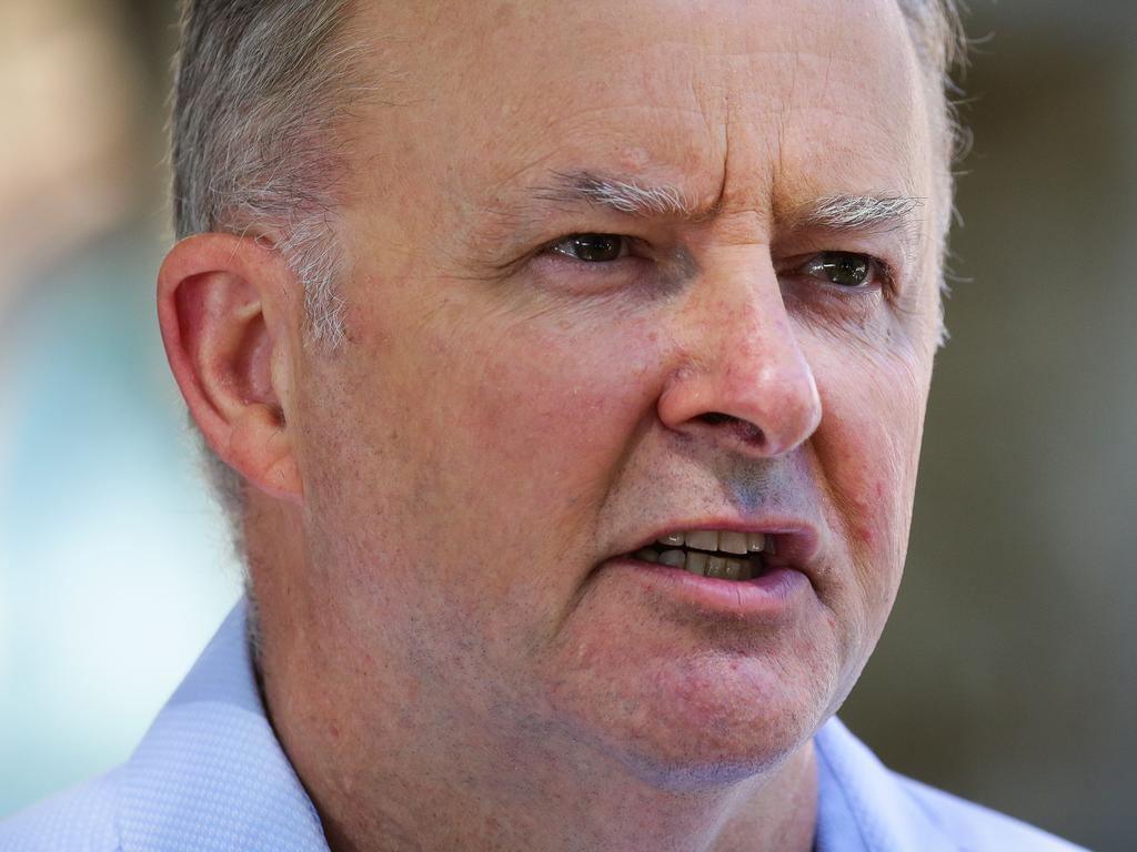 Anthony Albanese | Herald Sun