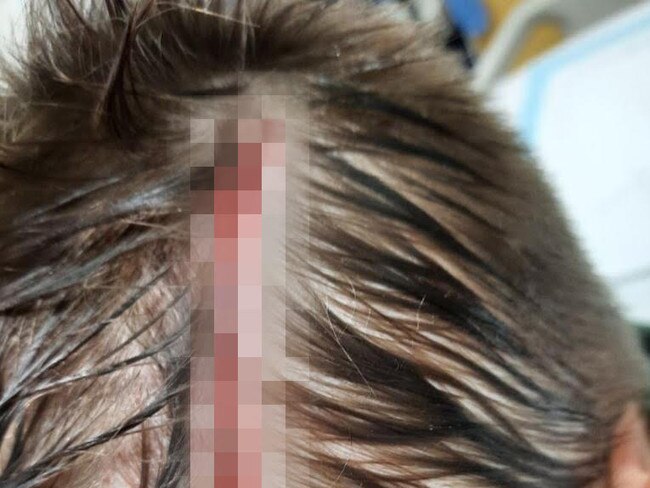 A six-year-old was left “covered in blood” after sustaining head lacerations from a wallaby attack before footy training.