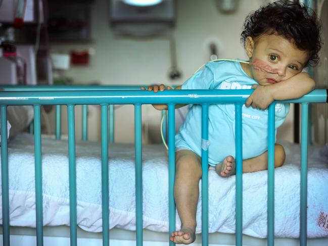 Harlen is being well cared for at the Royal Children's Hospital while he waits for his transplant. Picture: David Caird