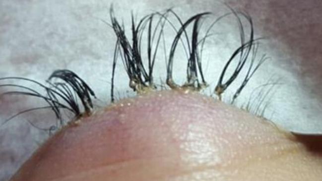 Perth salon owner Emma Dhanjal shared grotesque pictures of a botched eyelash extension. Picture: Facebook/Emmaculate Beauty