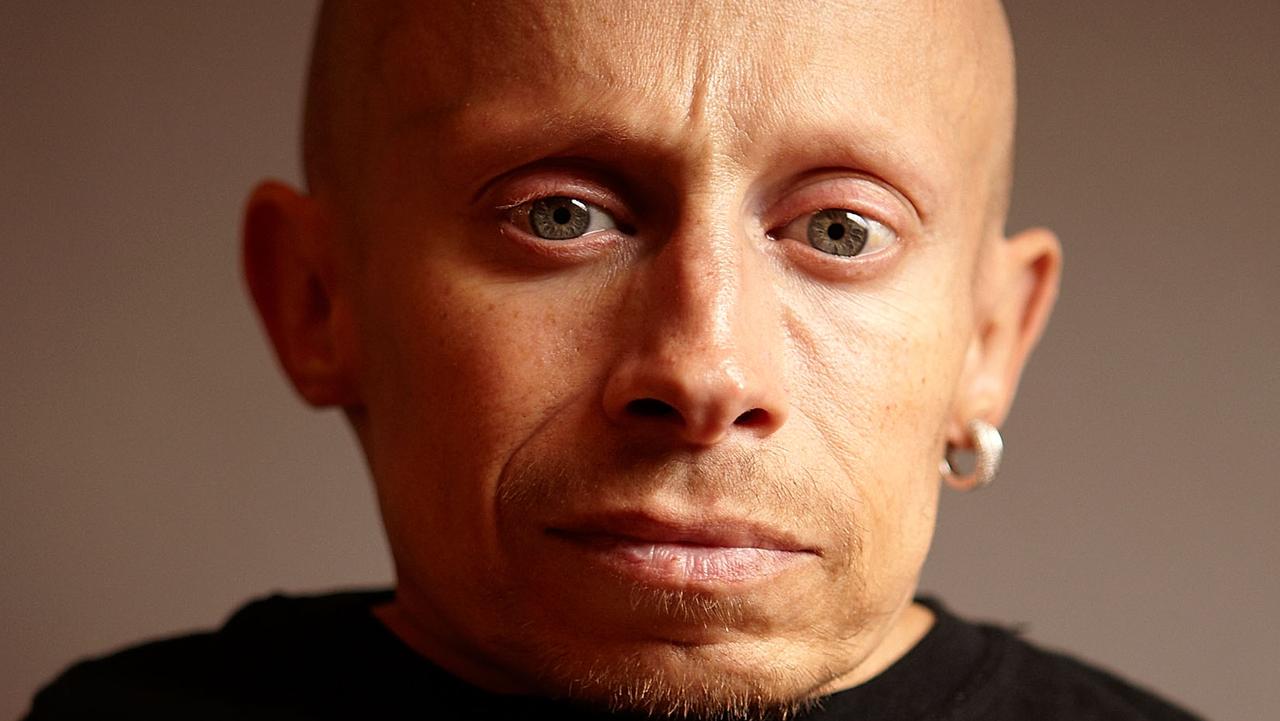 MiniMe dead Verne Troyer dead at 49 — Australia’s