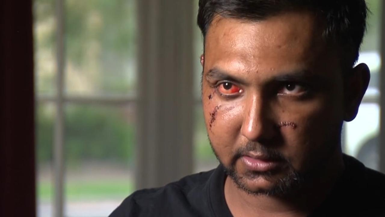 Muhammad Bilal speaks for the first time after a vicious attack. Picture: 7news