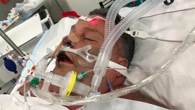 Jason Miller pictured in ICU at Northern Beaches Hospital. Picture: Supplied