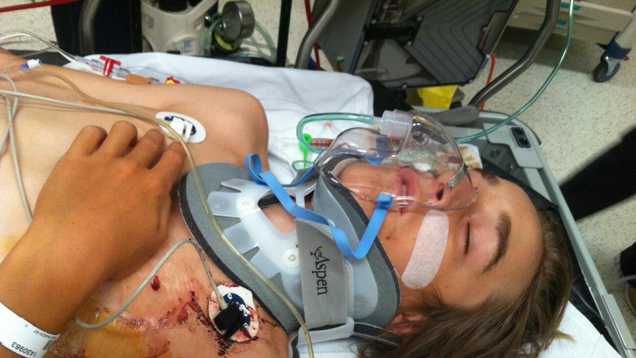 Ryan Meuleman after his accident. Picture: Supplied