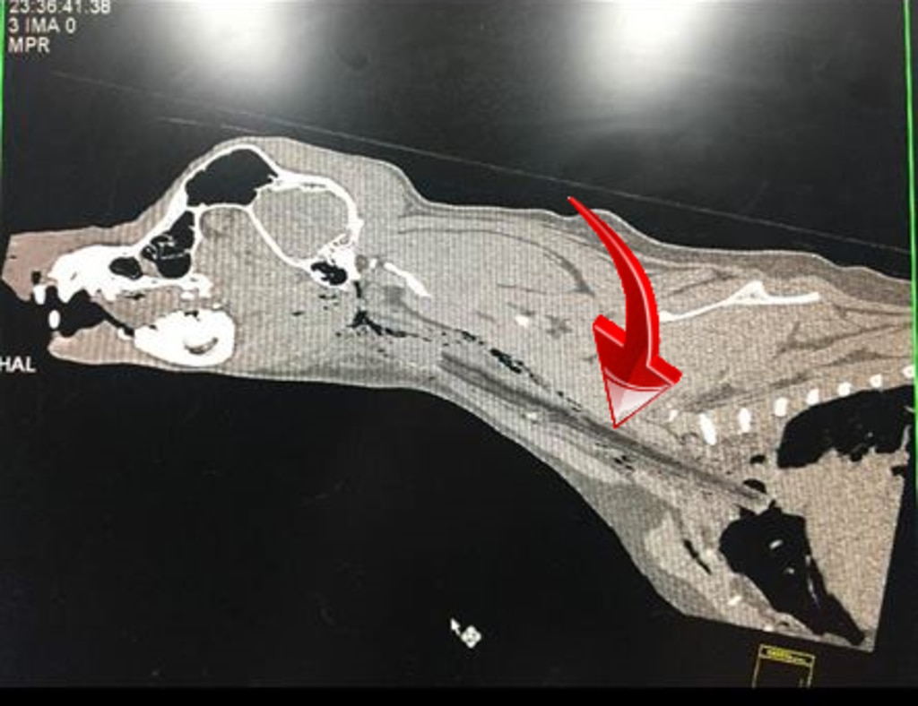 The X-ray revealed the stick was lodged behind Dash’s neck, causing him pain and discomfort. Picture: Facebook /Animal Referral Hospital.