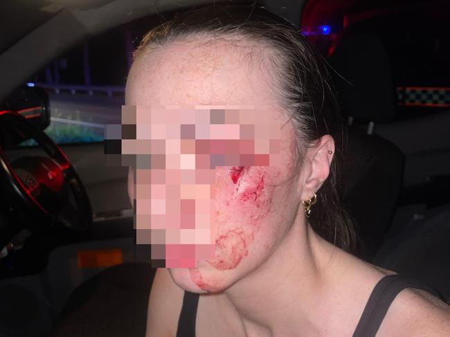 Mrs Brennan had to get two stitches after the incident. Picture: Supplied