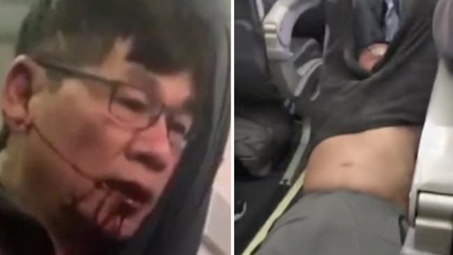 Shocking video showed Dr David Dao being dragged out of his seat and through the aisle of a United Airlines plane. Picture: AP