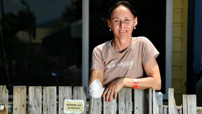 Garbutt resident Annmarie Walters lost her arm in a dog attack. Picture: Evan Morgan