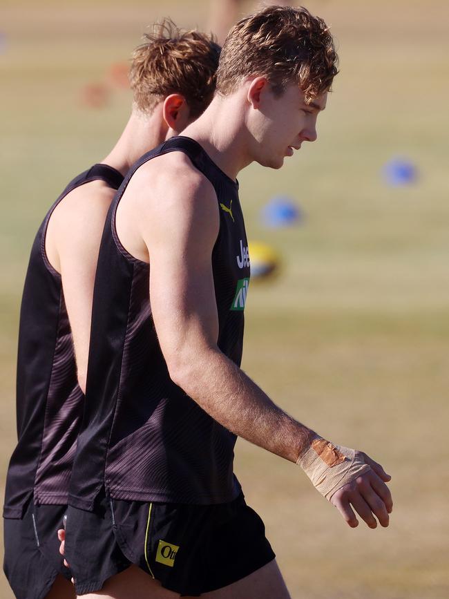 Injured forward Tom Lynch with his hand bandaged upon the Tigers’ Gold Coast hub. Picture: Michael Klein