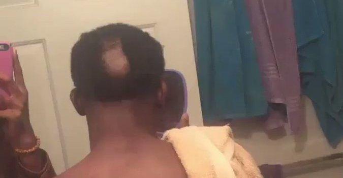 Man's Disastrous DIY Haircut Fail Goes Viral